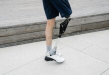 AI-Powered Prosthetic Knee: A Leap Forward in Bionic Technology Image by Pexels