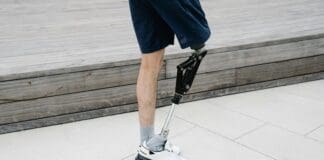 הברך התותבת המופעלת על ידי בינה מלאכותית – צעד קדימה עבור פצועים בשיקום Image by Pexels