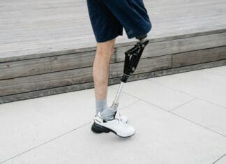 AI-Powered Prosthetic Knee: A Leap Forward in Bionic Technology Image by Pexels