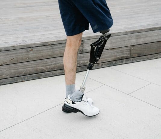 AI-Powered Prosthetic Knee: A Leap Forward in Bionic Technology Image by Pexels