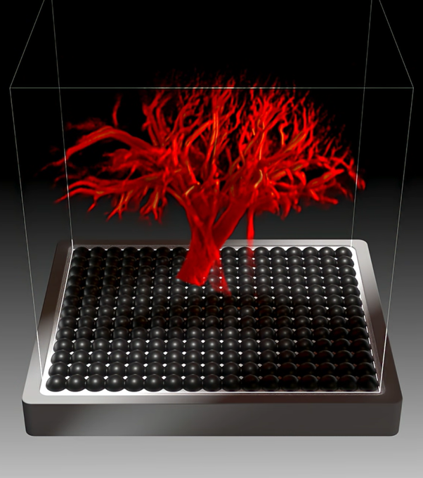 Image from Inserm on Youtube