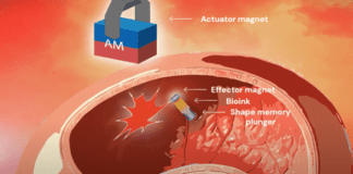 טכנולוגיה פורצת דרך לטיפול לא פולשני בפציעות פנימיות