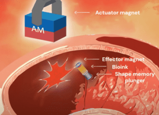 טכנולוגיה פורצת דרך לטיפול לא פולשני בפציעות פנימיות