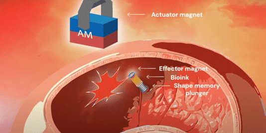 טכנולוגיה פורצת דרך לטיפול לא פולשני בפציעות פנימיות