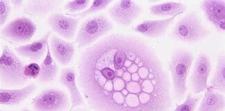 DeepMind’s AI Uncovers Clue to Unlocking “Cold” Cancerous Tumors