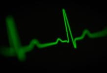 Heartbeat Tracking: Innovation or Overreach?