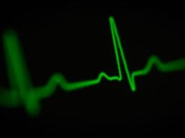Heartbeat Tracking: Innovation or Overreach?