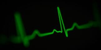 Heartbeat Tracking: Innovation or Overreach?