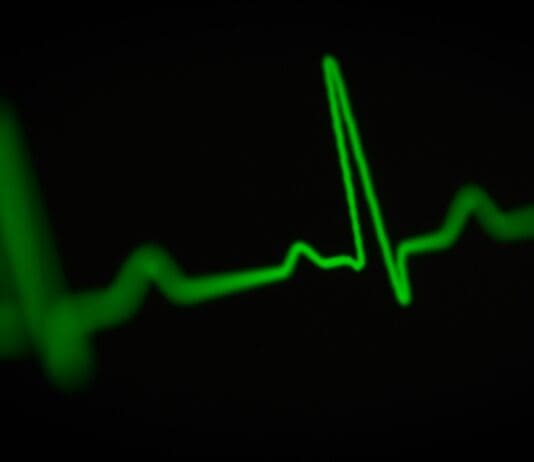 Heartbeat Tracking: Innovation or Overreach?